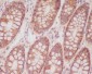 Anti-CD46 Rabbit Monoclonal Antibody